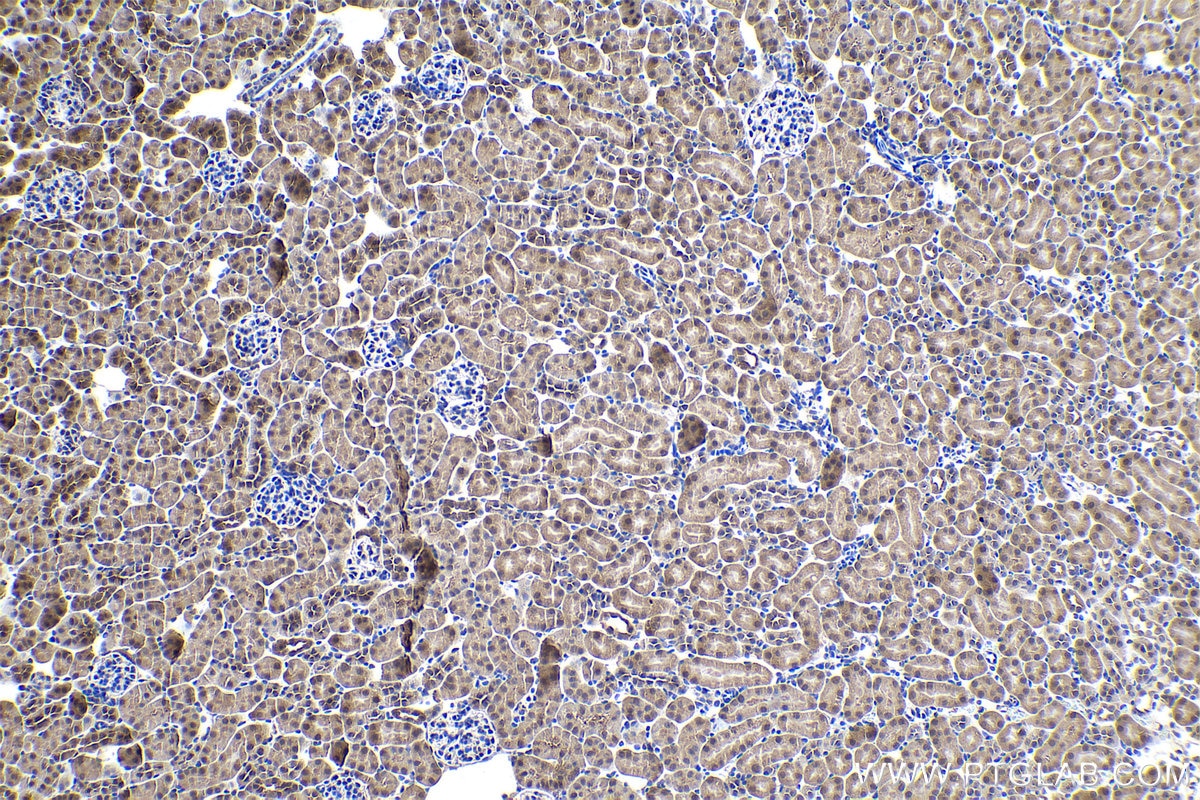 Immunohistochemical analysis of paraffin-embedded mouse kidney tissue slide using KHC0895 (PSMD13 IHC Kit).