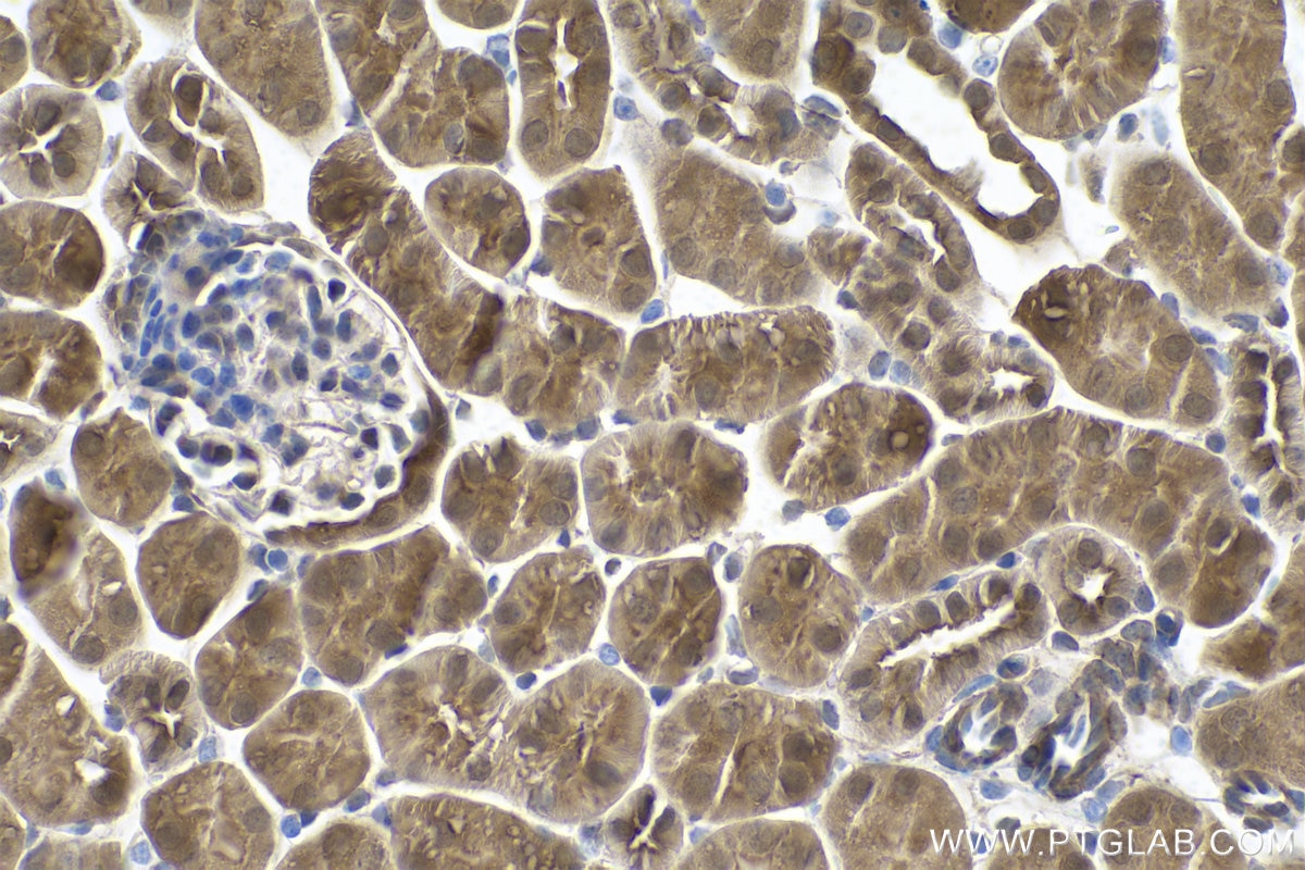 Immunohistochemical analysis of paraffin-embedded mouse kidney tissue slide using KHC0858 (PSMD5 IHC Kit).