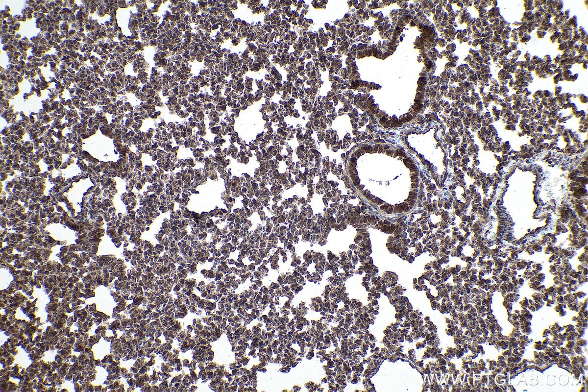 Immunohistochemical analysis of paraffin-embedded mouse lung tissue slide using KHC0858 (PSMD5 IHC Kit).