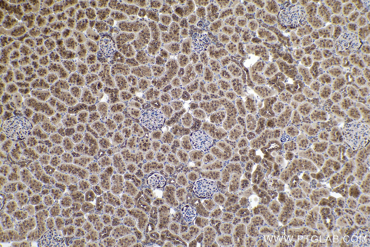 Immunohistochemical analysis of paraffin-embedded rat kidney tissue slide using KHC0858 (PSMD5 IHC Kit).