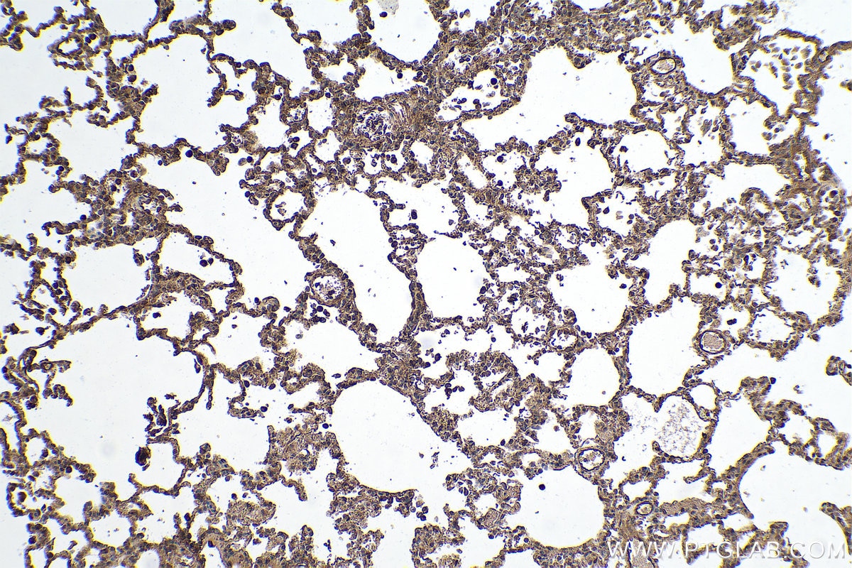 Immunohistochemical analysis of paraffin-embedded rat lung tissue slide using KHC0858 (PSMD5 IHC Kit).