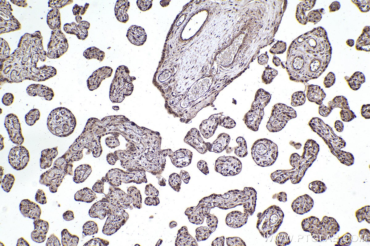 Immunohistochemical analysis of paraffin-embedded human placenta tissue slide using KHC2475 (PSMD6 IHC Kit).