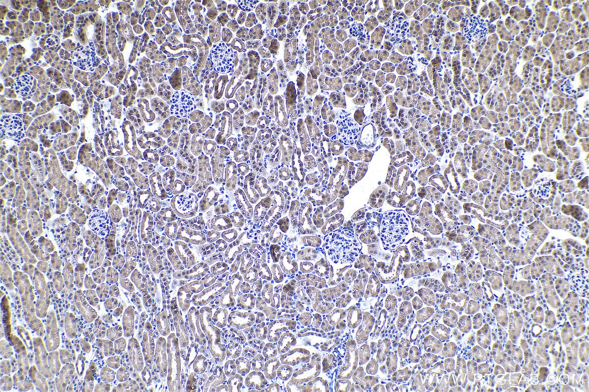 Immunohistochemical analysis of paraffin-embedded mouse kidney tissue slide using KHC0943 (PSMD7 IHC Kit).