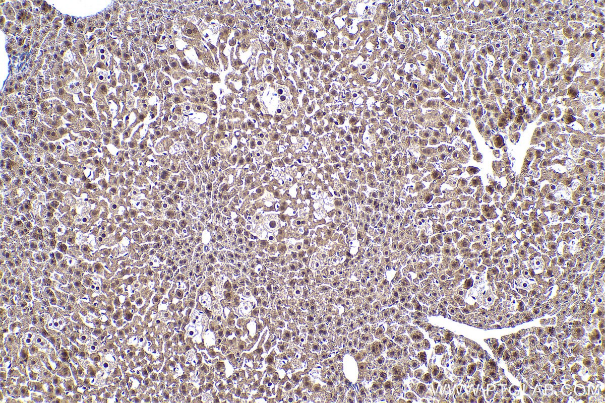 Immunohistochemical analysis of paraffin-embedded mouse liver tissue slide using KHC0943 (PSMD7 IHC Kit).