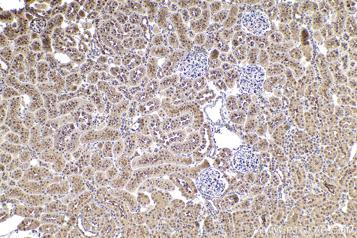 Immunohistochemical analysis of paraffin-embedded rat kidney tissue slide using KHC0943 (PSMD7 IHC Kit).