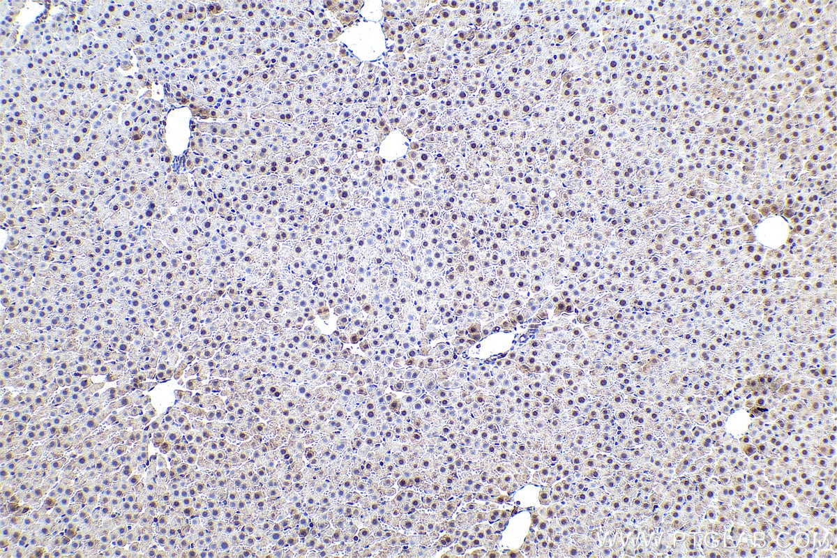 Immunohistochemical analysis of paraffin-embedded rat liver tissue slide using KHC0943 (PSMD7 IHC Kit).