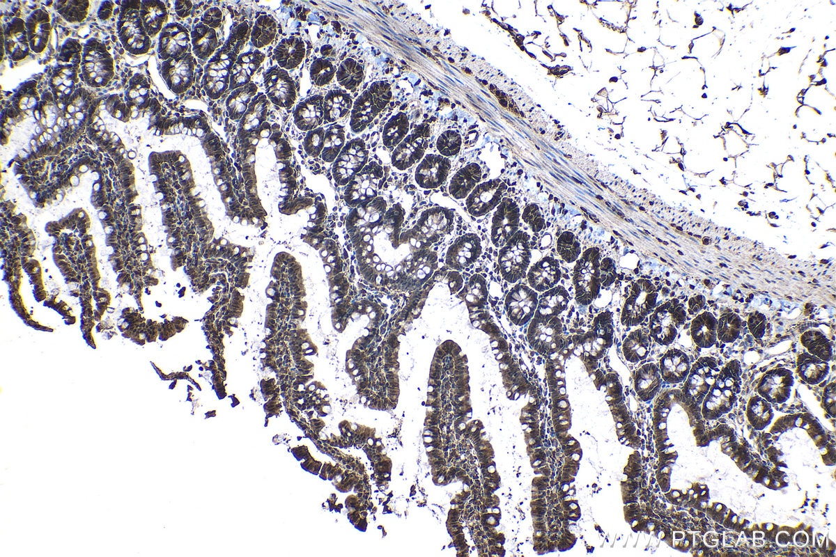 Immunohistochemical analysis of paraffin-embedded rat small intestine tissue slide using KHC1142 (PSME1 IHC Kit).