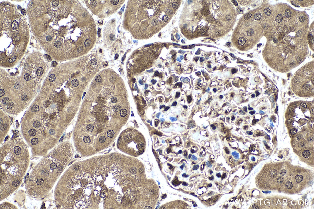 Immunohistochemical analysis of paraffin-embedded human kidney tissue slide using KHC0449 (PSME2 IHC Kit).