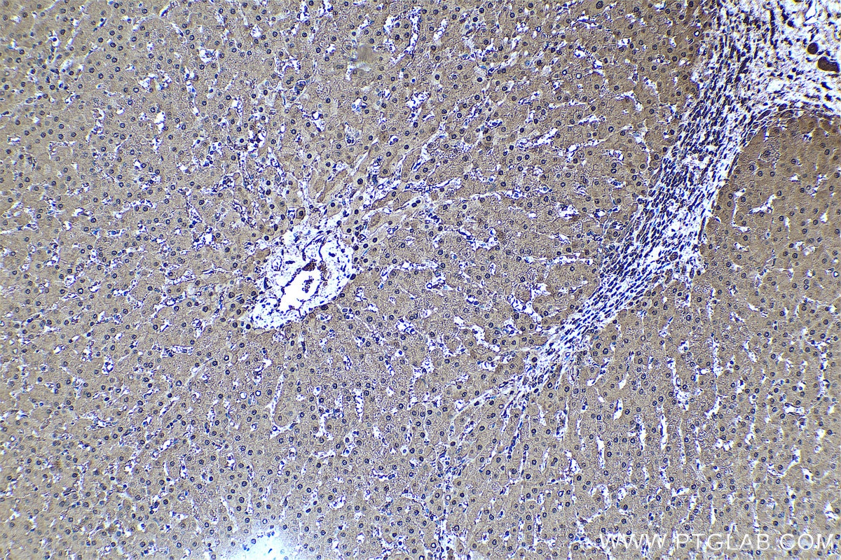 Immunohistochemical analysis of paraffin-embedded human liver tissue slide using KHC0449 (PSME2 IHC Kit).