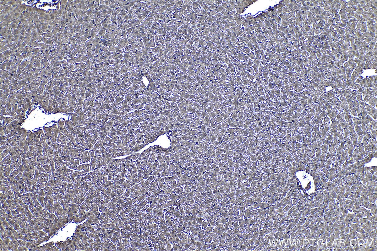 Immunohistochemical analysis of paraffin-embedded mouse liver tissue slide using KHC0449 (PSME2 IHC Kit).