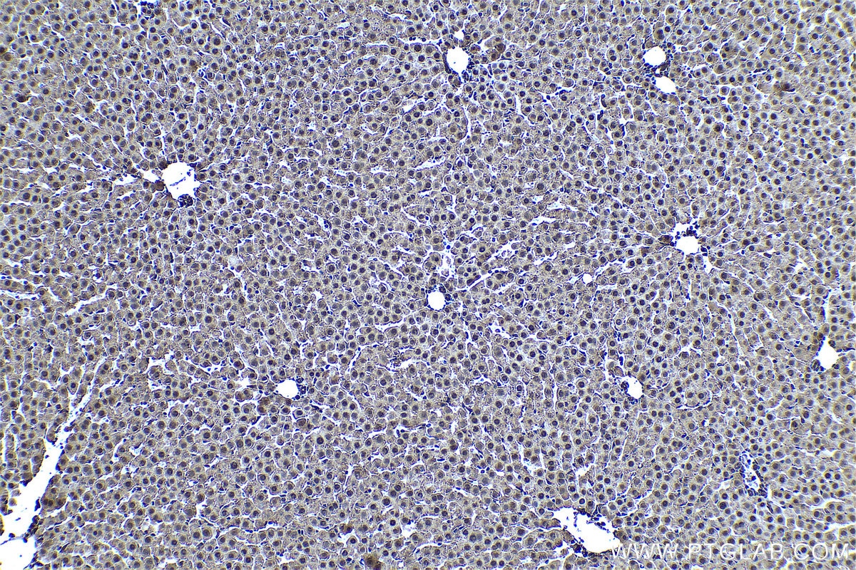 Immunohistochemical analysis of paraffin-embedded rat liver tissue slide using KHC0449 (PSME2 IHC Kit).