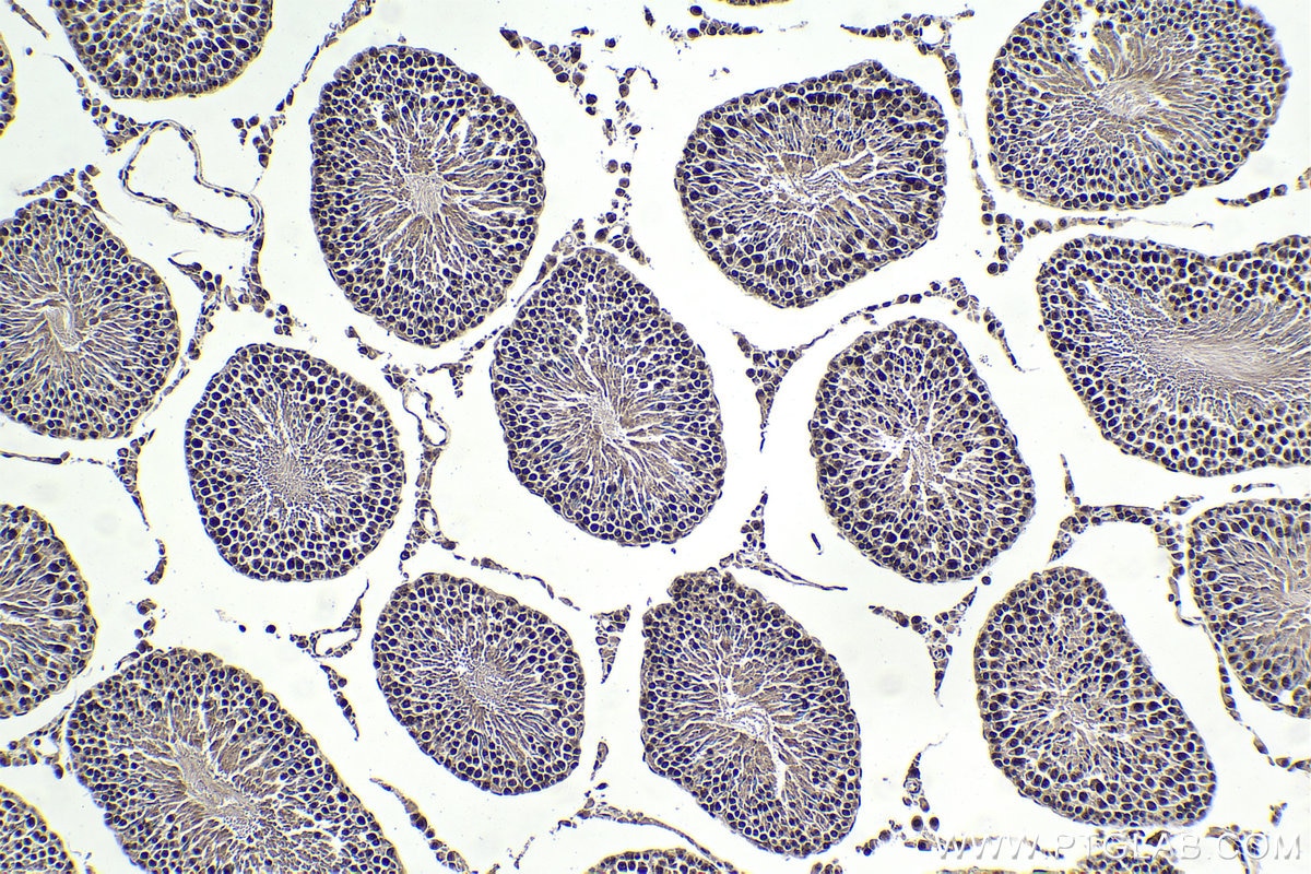 Immunohistochemical analysis of paraffin-embedded rat testis tissue slide using KHC1745 (PSME4 IHC Kit).