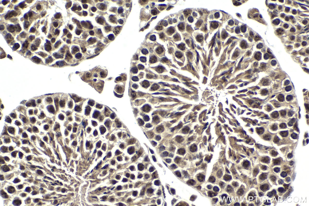 Immunohistochemical analysis of paraffin-embedded mouse testis tissue slide using KHC1745 (PSME4 IHC Kit).