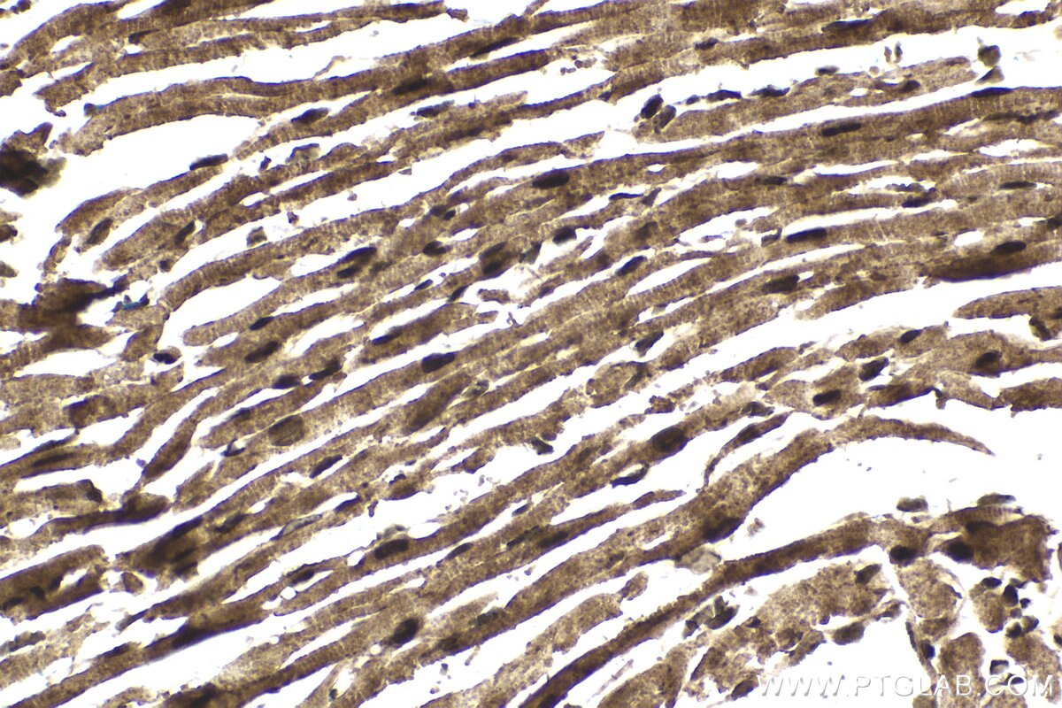 Immunohistochemical analysis of paraffin-embedded mouse heart tissue slide using KHC1745 (PSME4 IHC Kit).