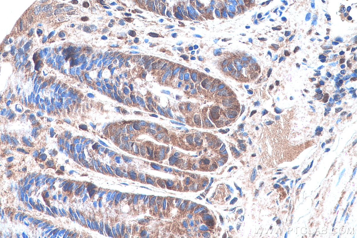 Immunohistochemical analysis of paraffin-embedded mouse colon tissue slide using KHC0280 (PTEN IHC Kit).