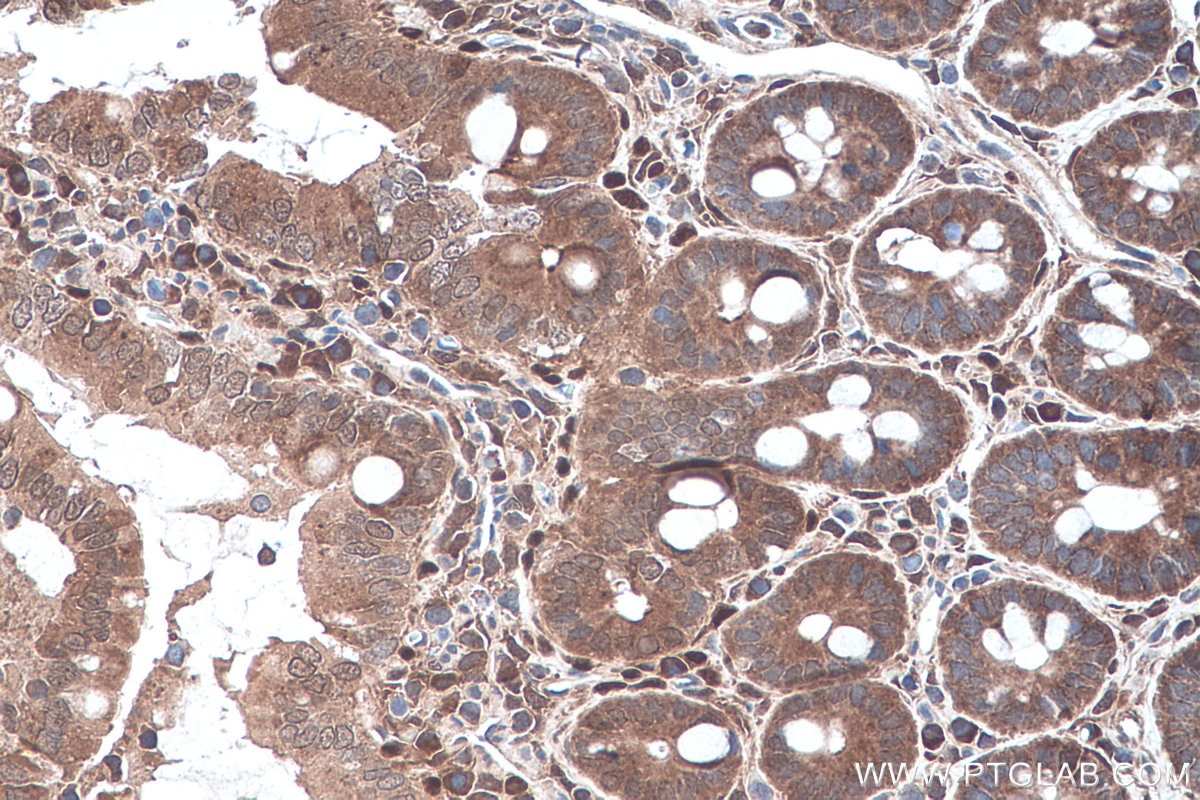 Immunohistochemical analysis of paraffin-embedded rat colon tissue slide using KHC0280 (PTEN IHC Kit).