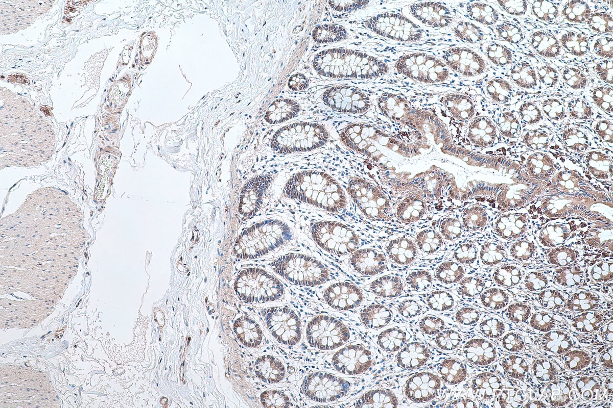 Immunohistochemical analysis of paraffin-embedded human colon tissue slide using KHC0280 (PTEN IHC Kit).