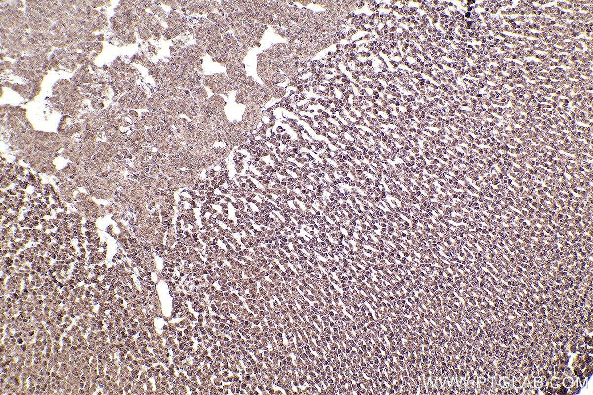 Immunohistochemical analysis of paraffin-embedded rat adrenal gland tissue slide using KHC2457 (PTK2B IHC Kit).
