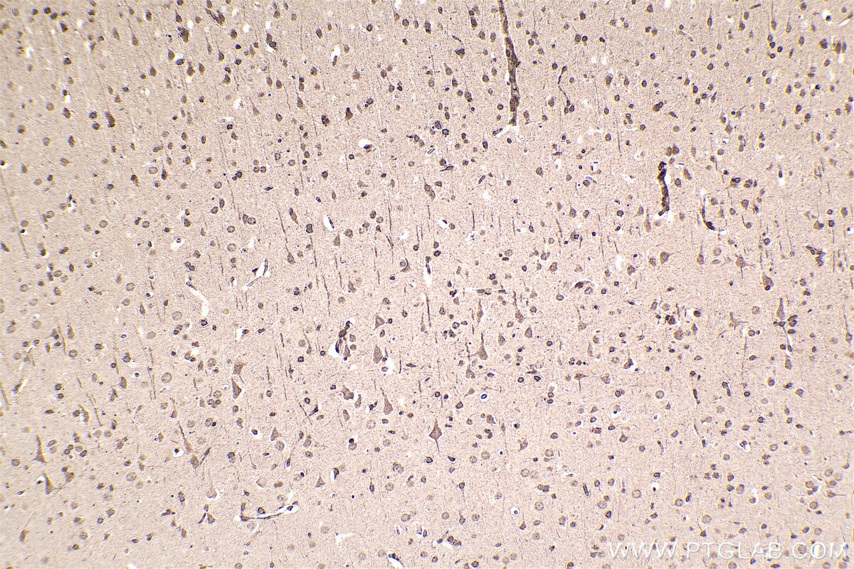 Immunohistochemical analysis of paraffin-embedded rat brain tissue slide using KHC2457 (PTK2B IHC Kit).