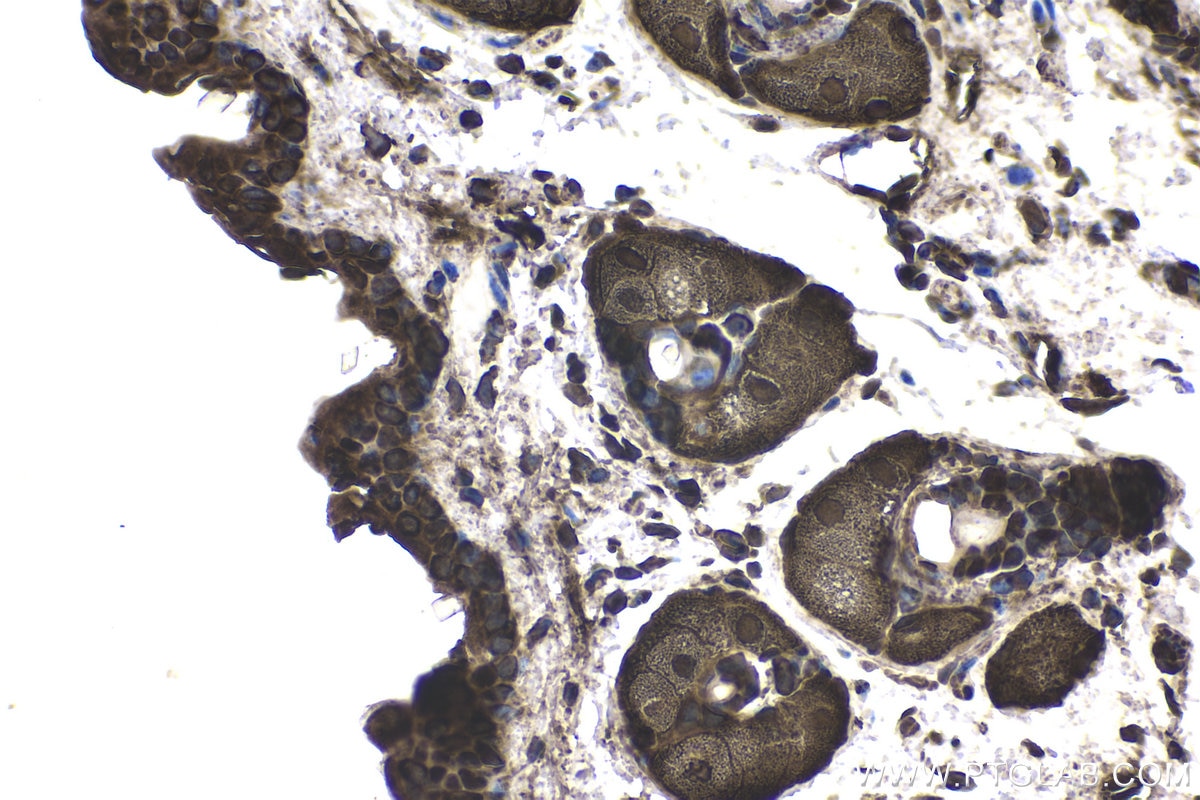 Immunohistochemical analysis of paraffin-embedded mouse skin tissue slide using KHC1721 (PTK6/BRK IHC Kit).