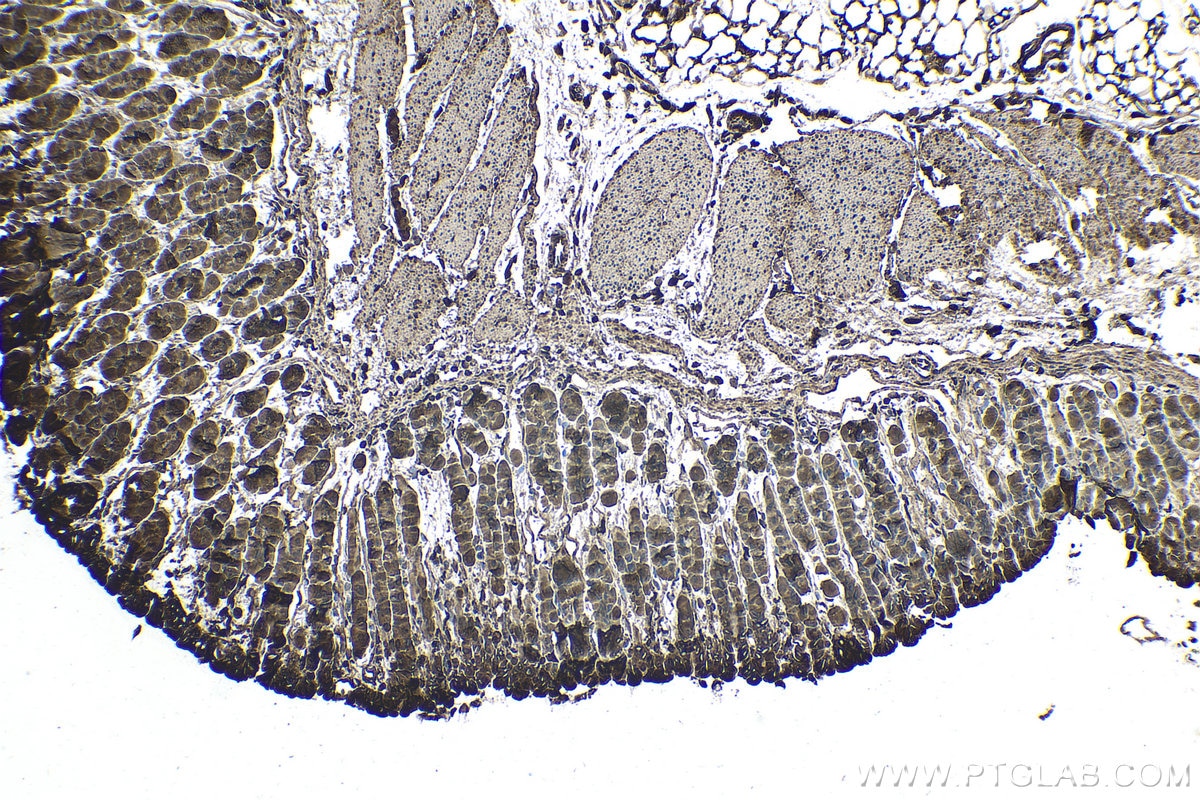 Immunohistochemical analysis of paraffin-embedded mouse stomach tissue slide using KHC1721 (PTK6/BRK IHC Kit).