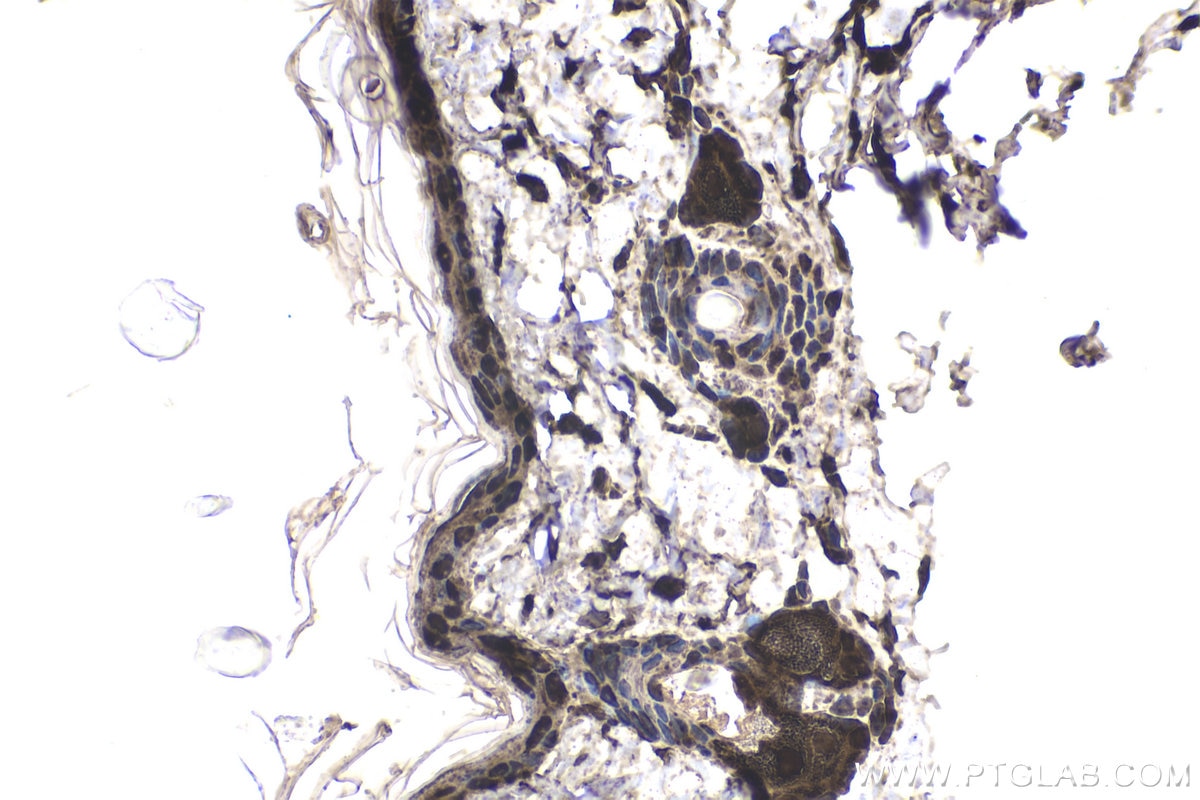 Immunohistochemical analysis of paraffin-embedded rat skin tissue slide using KHC1721 (PTK6/BRK IHC Kit).