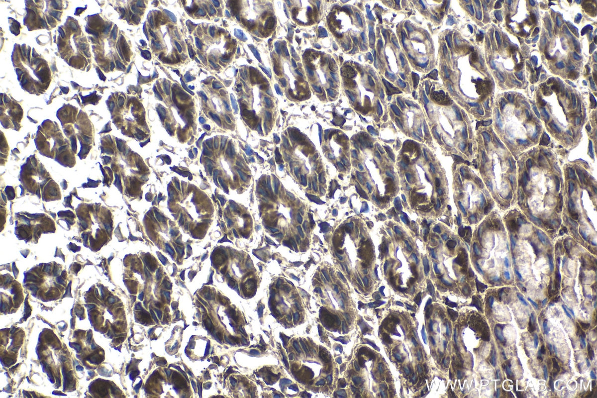 Immunohistochemical analysis of paraffin-embedded rat stomach tissue slide using KHC1721 (PTK6/BRK IHC Kit).