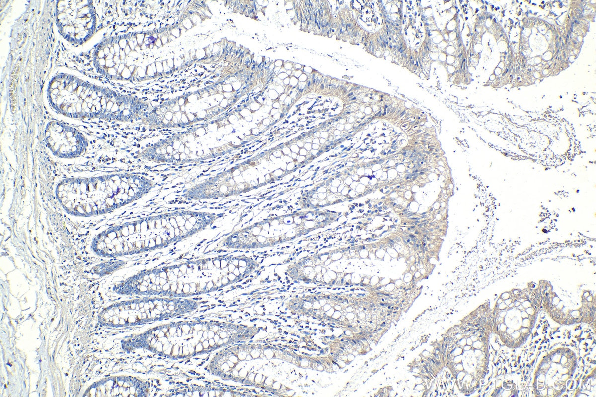 Immunohistochemical analysis of paraffin-embedded human colon tissue slide using KHC1263 (PTP4A1 IHC Kit).