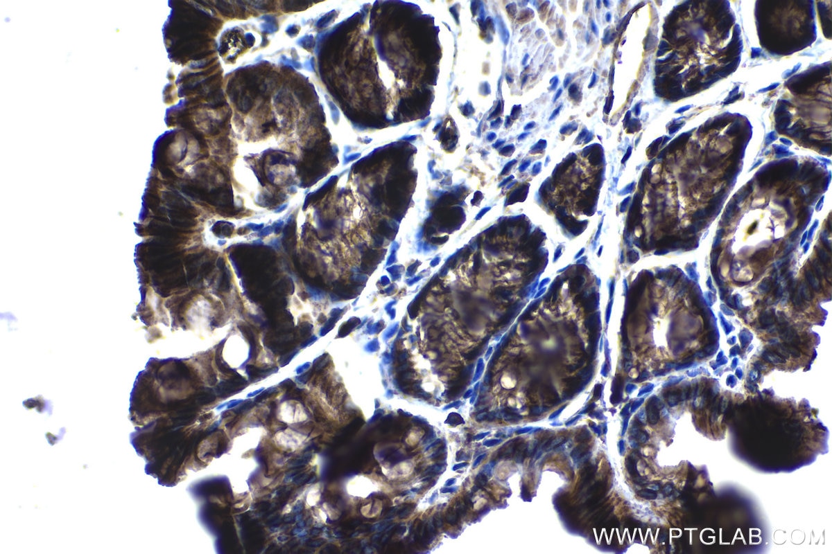 Immunohistochemical analysis of paraffin-embedded mouse colon tissue slide using KHC1263 (PTP4A1 IHC Kit).
