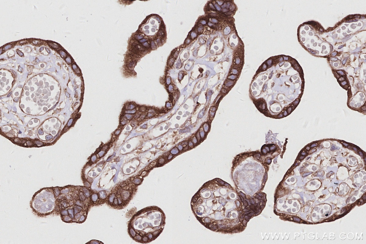 Immunohistochemical analysis of paraffin-embedded human placenta tissue slide using KHC2983 (PTPLAD1 IHC Kit). Immunohistochemical analysis of paraffin-embedded human placenta tissue slide using KHC2983 (PTPLAD1 IHC Kit).
