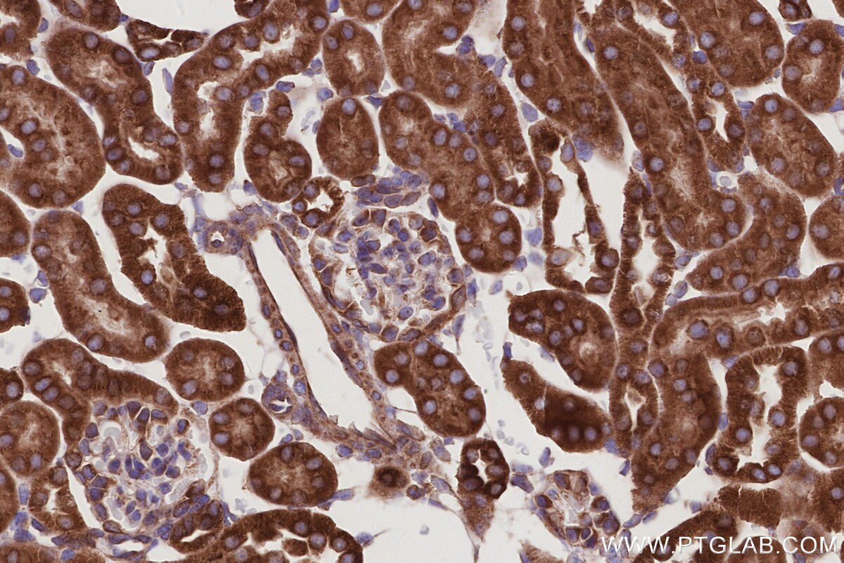 Immunohistochemical analysis of paraffin-embedded mouse kidney tissue slide using KHC2983 (PTPLAD1 IHC Kit). Immunohistochemical analysis of paraffin-embedded mouse kidney tissue slide using KHC2983 (PTPLAD1 IHC Kit).