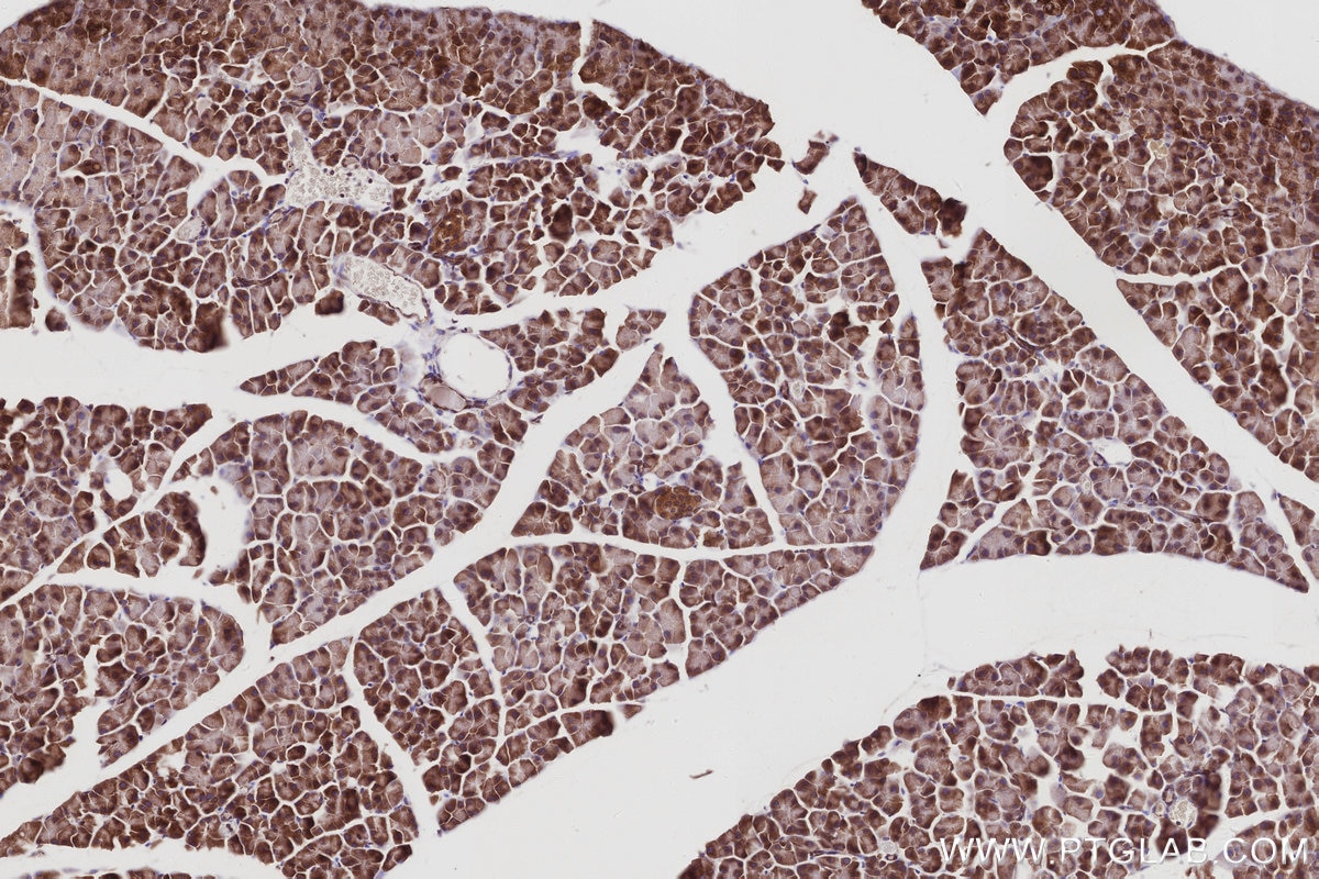 Immunohistochemical analysis of paraffin-embedded mouse pancreas tissue slide using KHC2983 (PTPLAD1 IHC Kit). Immunohistochemical analysis of paraffin-embedded mouse pancreas tissue slide using KHC2983 (PTPLAD1 IHC Kit).