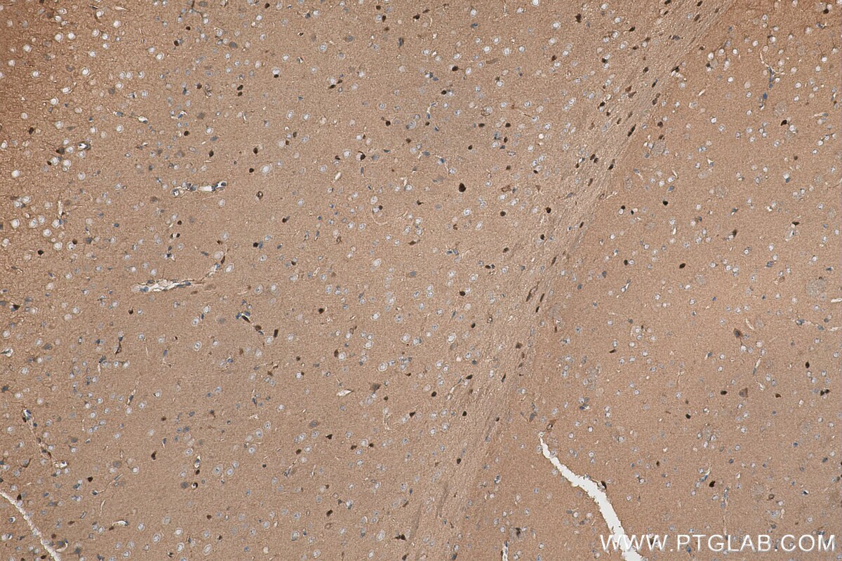 Immunohistochemical analysis of paraffin-embedded mouse brain tissue slide using KHC0964 (PTPN11 IHC Kit).