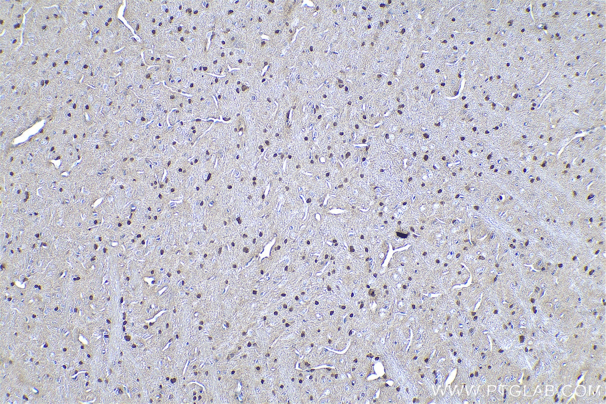 Immunohistochemical analysis of paraffin-embedded rat brain tissue slide using KHC0964 (PTPN11 IHC Kit).