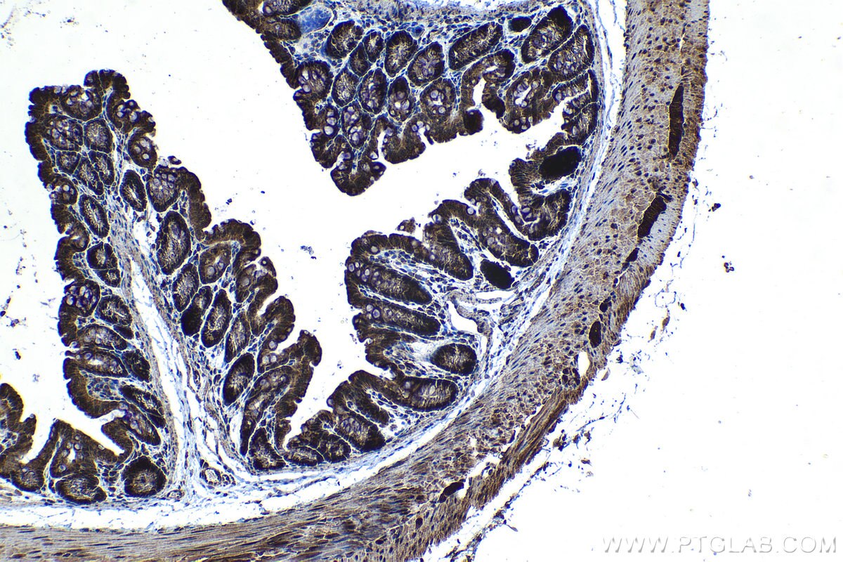 Immunohistochemical analysis of paraffin-embedded mouse colon tissue slide using KHC1316 (PTPN2 IHC Kit).