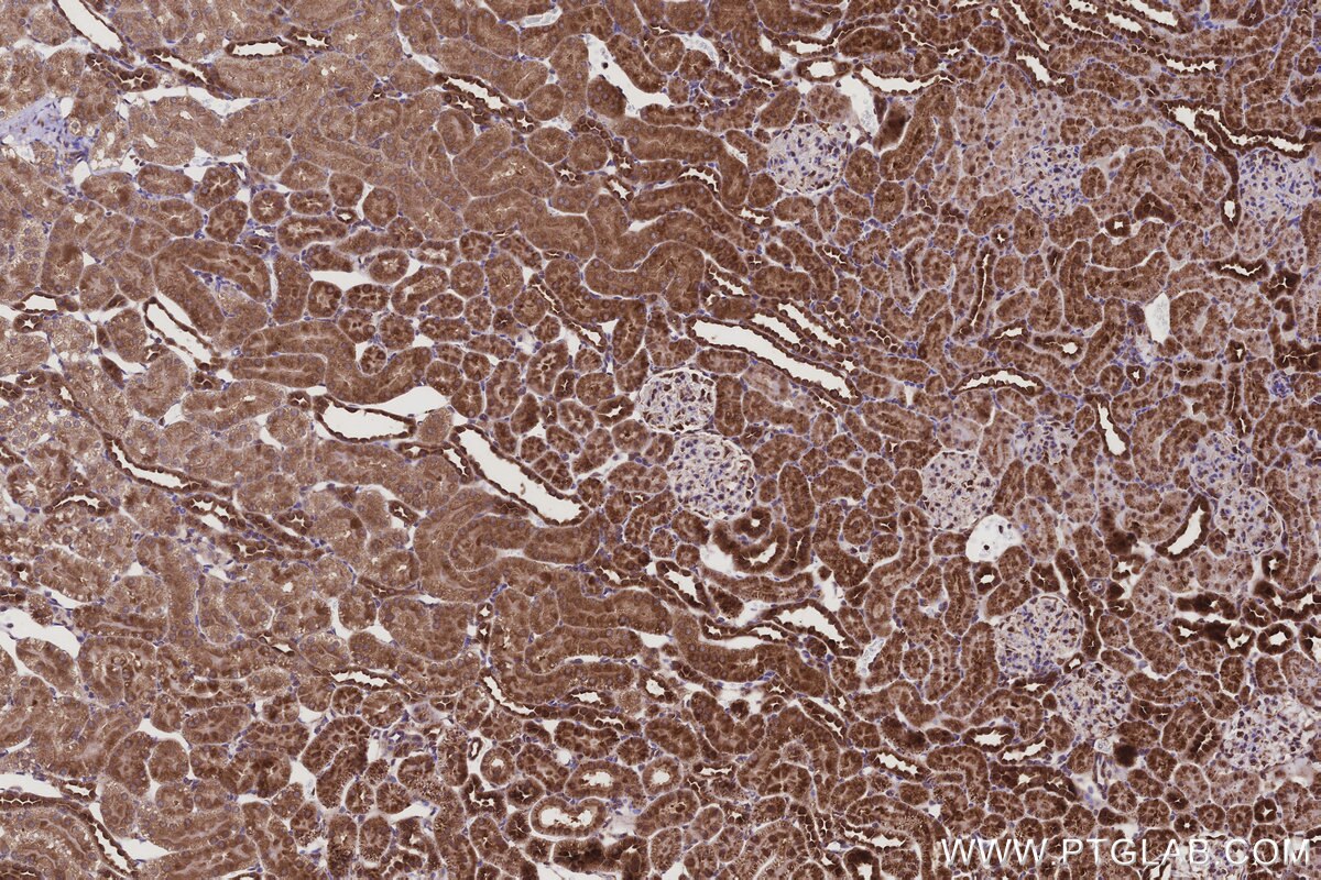 Immunohistochemical analysis of paraffin-embedded rat kidney tissue slide using KHC3210 (PTPN9 IHC Kit). Immunohistochemical analysis of paraffin-embedded rat kidney tissue slide using KHC3210 (PTPN9 IHC Kit).