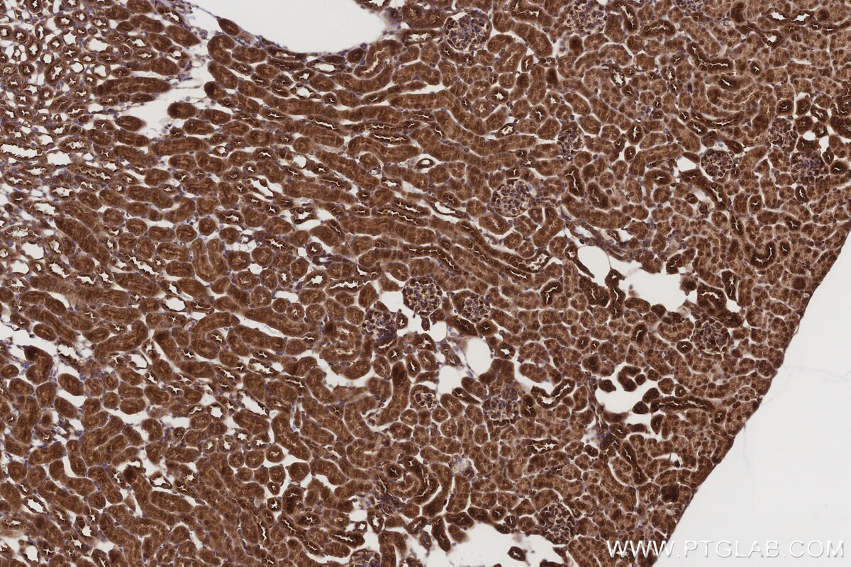Immunohistochemical analysis of paraffin-embedded mouse kidney tissue slide using KHC3210 (PTPN9 IHC Kit). Immunohistochemical analysis of paraffin-embedded mouse kidney tissue slide using KHC3210 (PTPN9 IHC Kit).