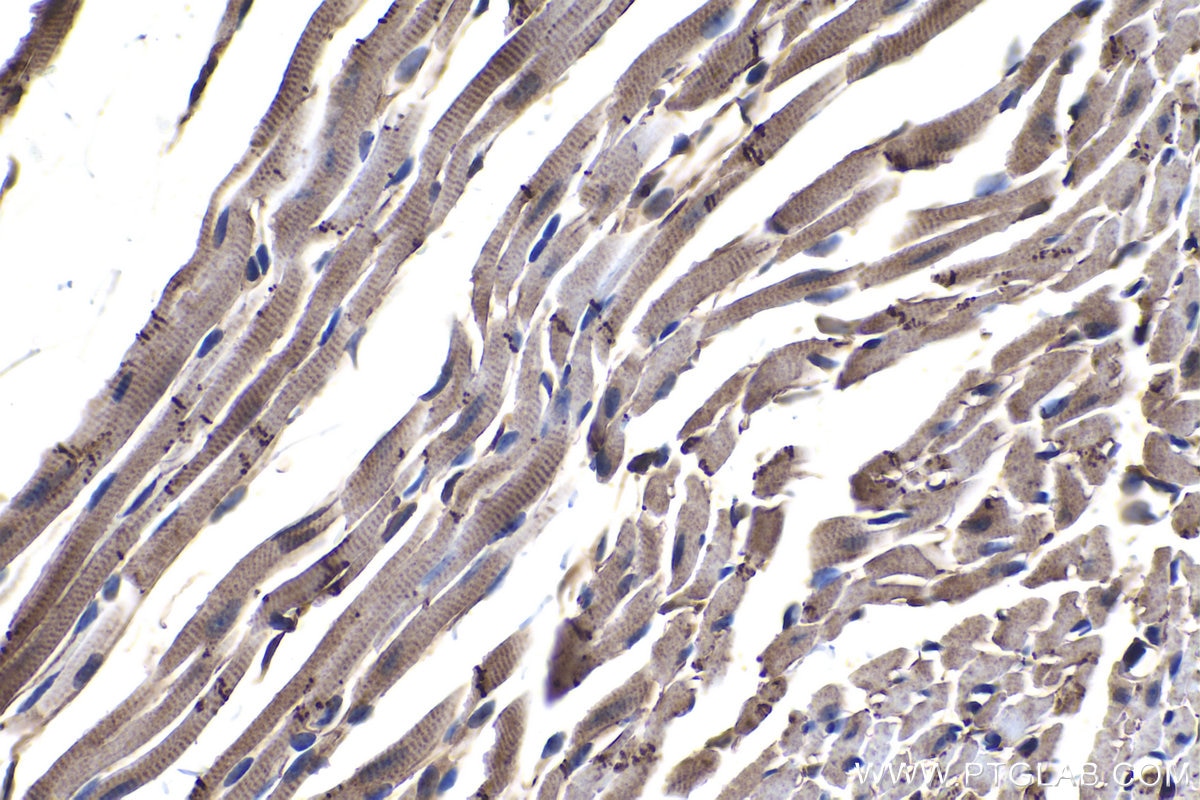 Immunohistochemical analysis of paraffin-embedded mouse heart tissue slide using KHC1073 (PTPRA IHC Kit).