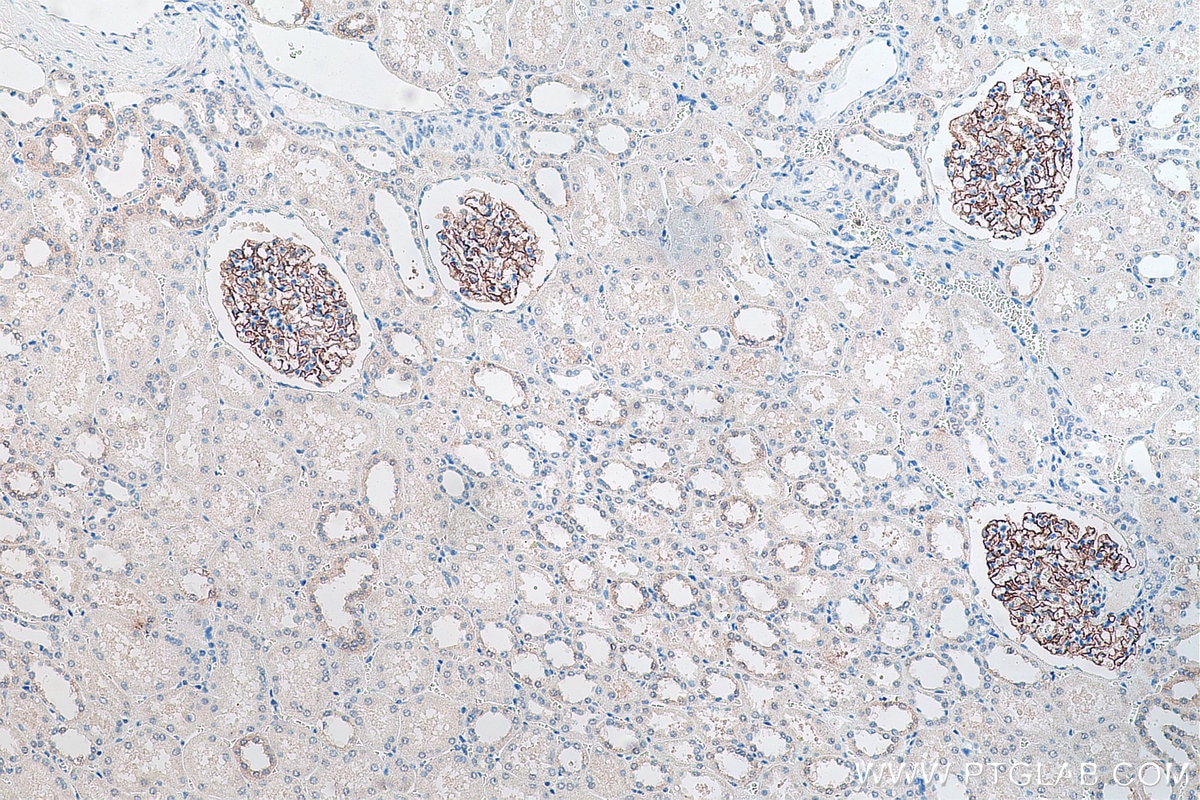 Immunohistochemical analysis of paraffin-embedded human kidney tissue slide using KHC0082 (PTPRO IHC Kit).