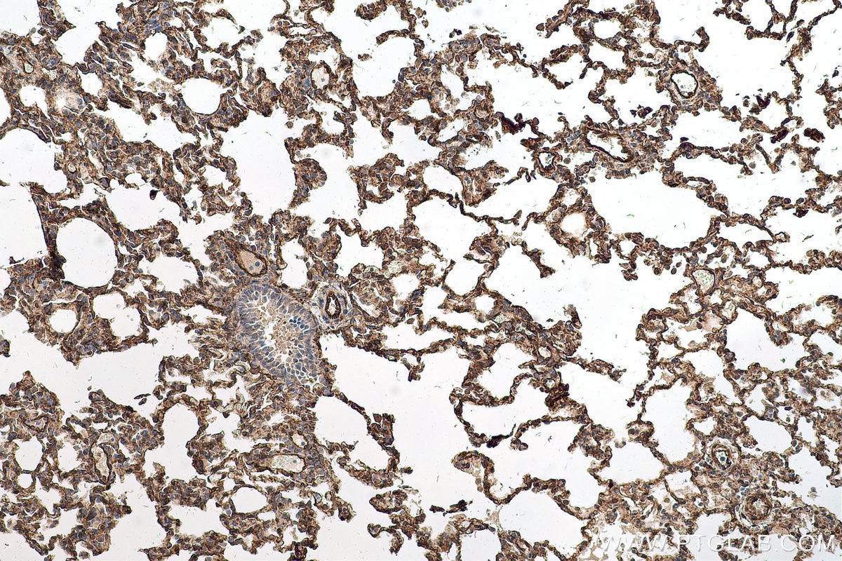 Immunohistochemical analysis of paraffin-embedded rat lung tissue slide using KHC0677 (PTRF IHC Kit).