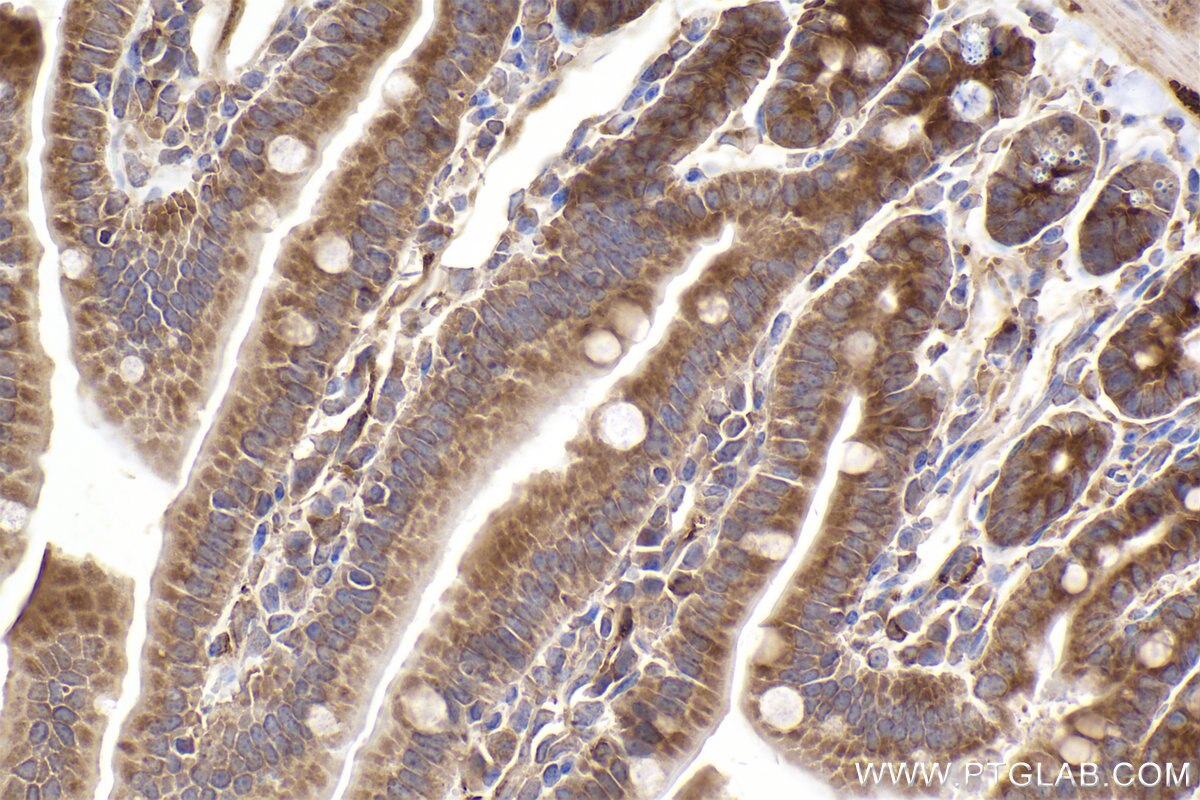 Immunohistochemical analysis of paraffin-embedded mouse small intestine tissue slide using KHC2515 (PUM1 IHC Kit).