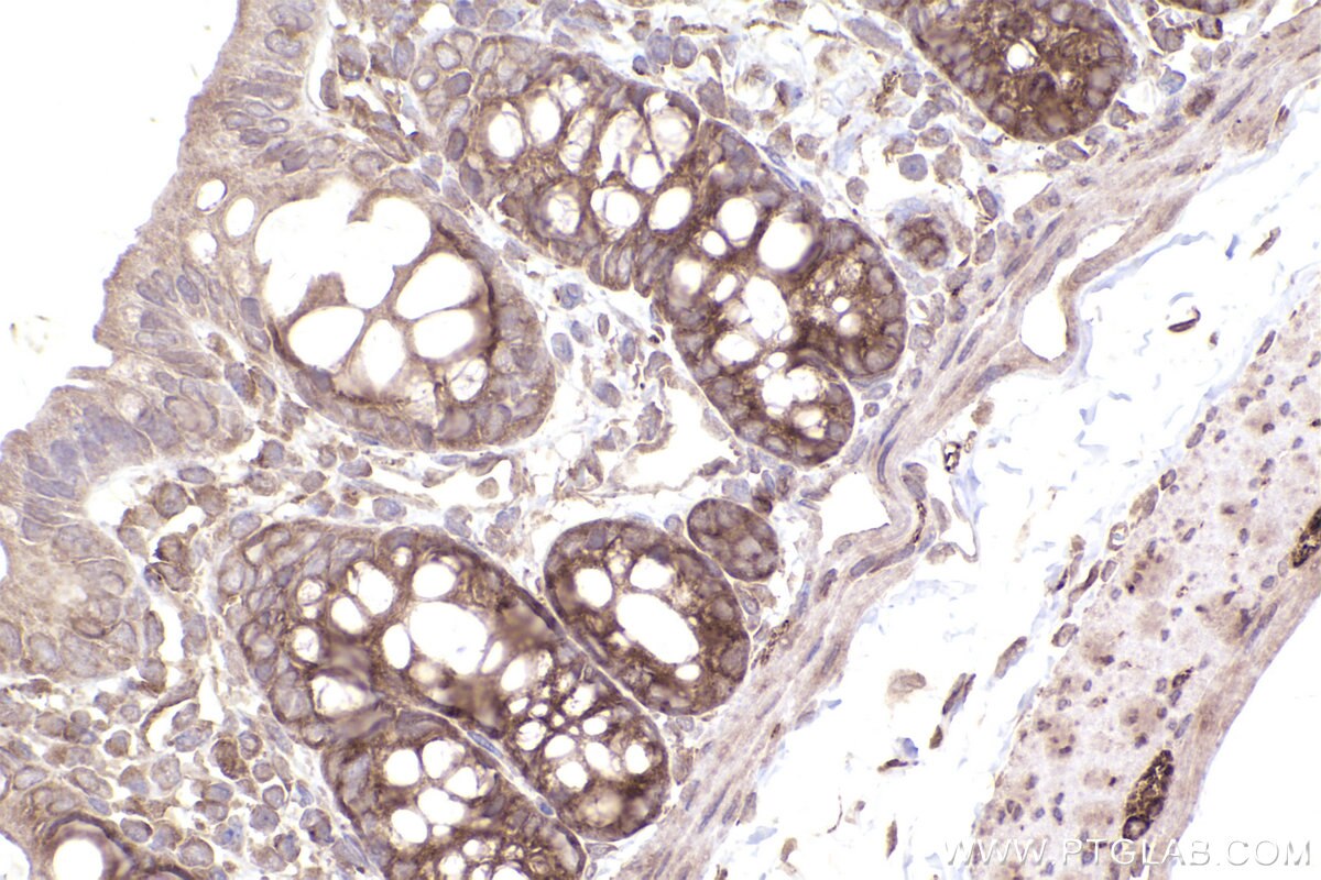 Immunohistochemical analysis of paraffin-embedded rat colon tissue slide using KHC2515 (PUM1 IHC Kit).