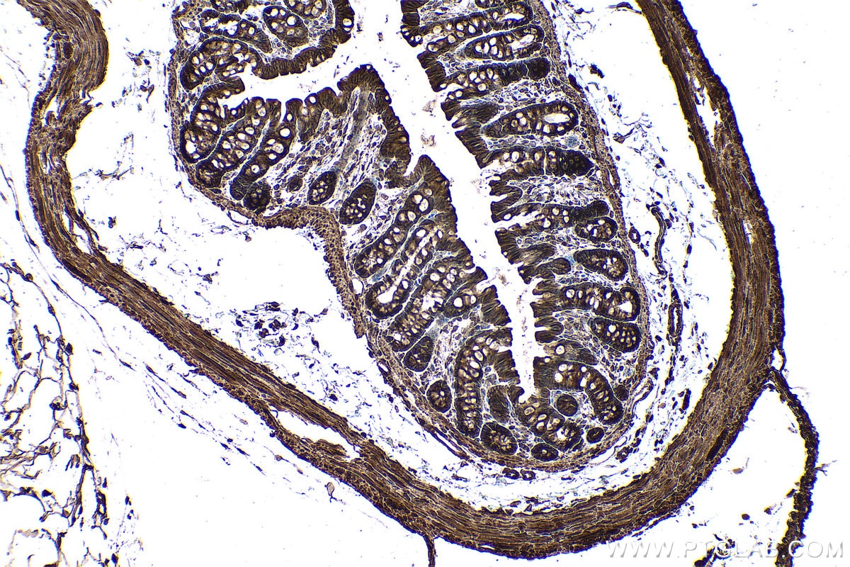 Immunohistochemical analysis of paraffin-embedded rat colon tissue slide using KHC0970 (PYGB IHC Kit).