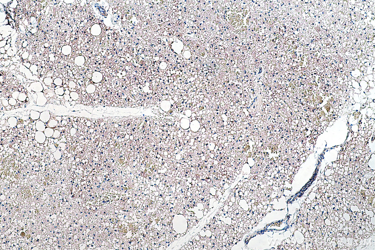 Immunohistochemical analysis of paraffin-embedded rat brown adipose tissue slide using KHC0230 (Perilipin 5 IHC Kit).