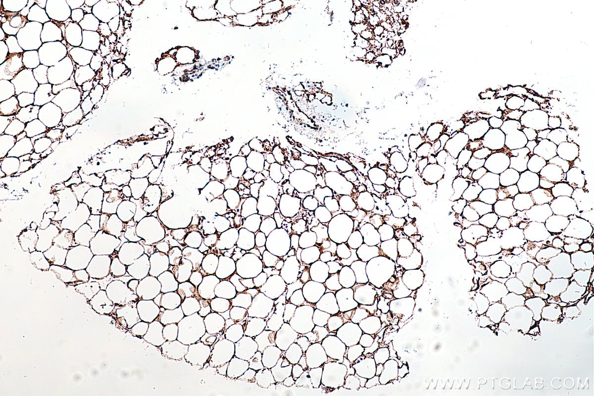 Immunohistochemical analysis of paraffin-embedded mouse brown adipose tissue slide using KHC0230 (Perilipin 5 IHC Kit).