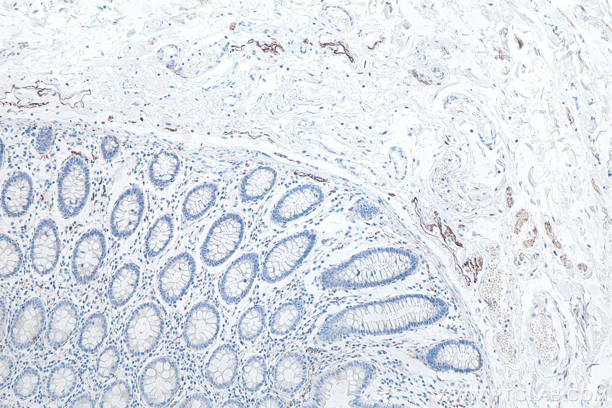Immunohistochemical analysis of paraffin-embedded human colon tissue slide using KHC0092 (Podoplanin IHC Kit).