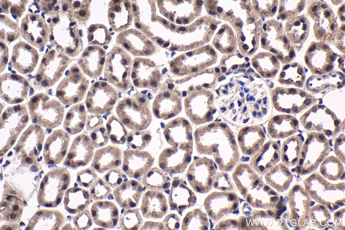 Immunohistochemical analysis of paraffin-embedded mouse kidney tissue slide using KHC1767 (QRICH1 IHC Kit).
