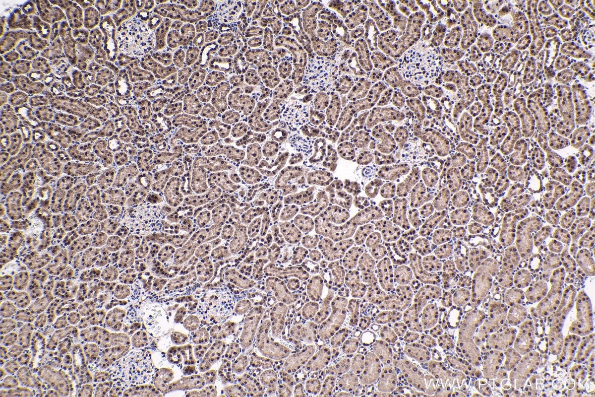 Immunohistochemical analysis of paraffin-embedded rat kidney tissue slide using KHC1767 (QRICH1 IHC Kit).