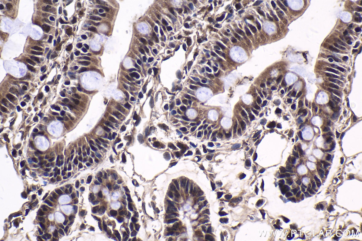 Immunohistochemical analysis of paraffin-embedded rat small intestine tissue slide using KHC1767 (QRICH1 IHC Kit).