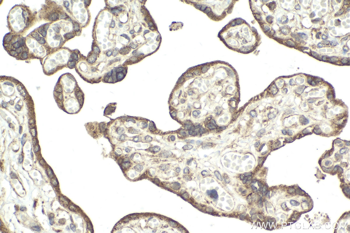 Immunohistochemical analysis of paraffin-embedded human placenta tissue slide using KHC2043 (QSOX1 IHC Kit).